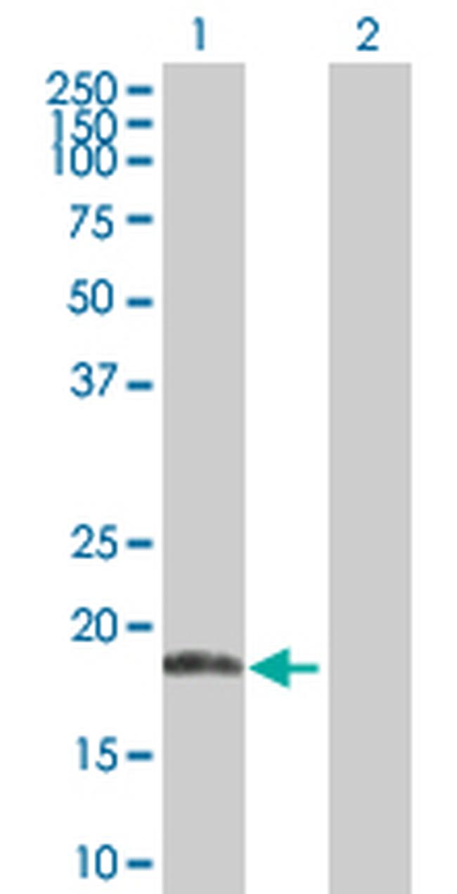 ANK1 Antibody in Western Blot (WB)