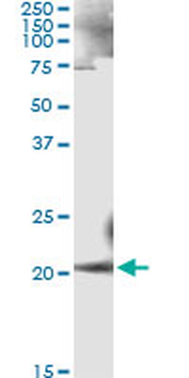 ANK1 Antibody in Immunoprecipitation (IP)