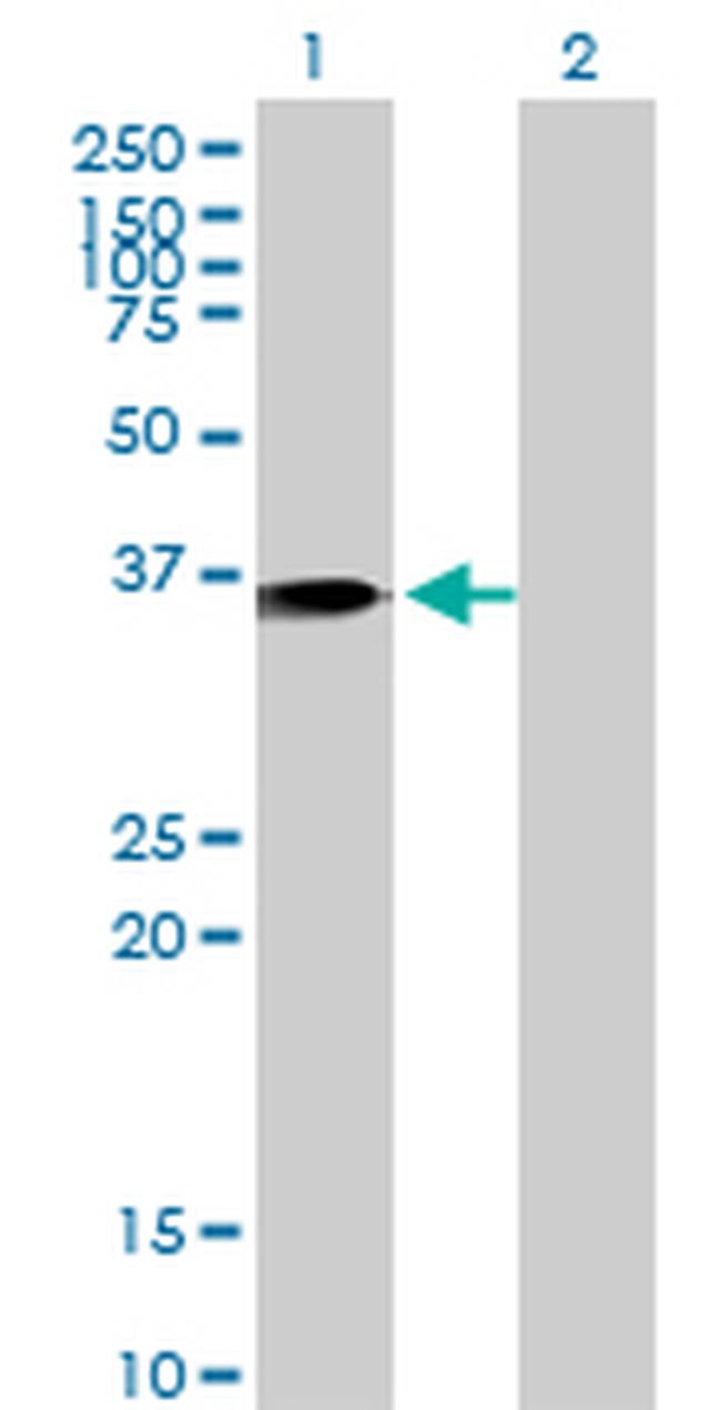 ANXA1 Antibody in Western Blot (WB)