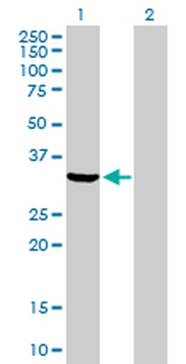 ANXA5 Antibody in Western Blot (WB)