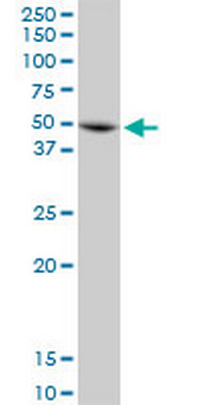 ANXA7 Antibody in Western Blot (WB)