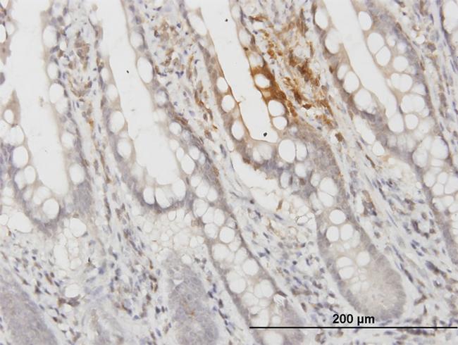 APOF Antibody in Immunohistochemistry (Paraffin) (IHC (P))