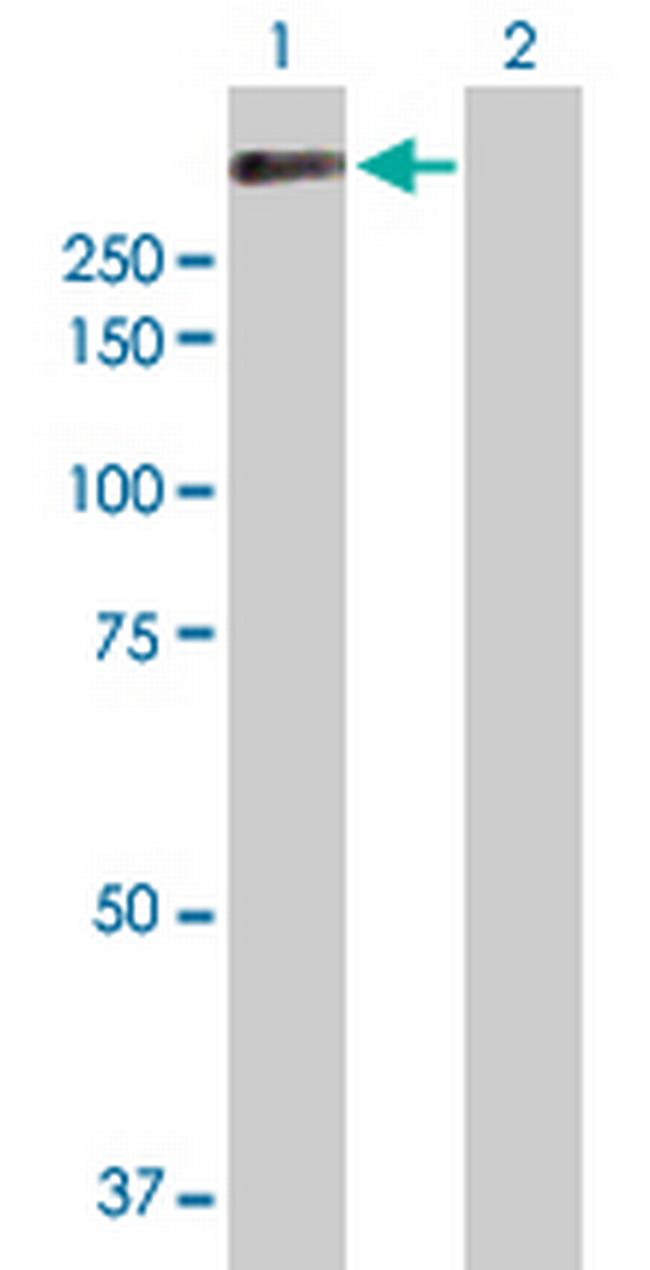 APC Antibody in Western Blot (WB)