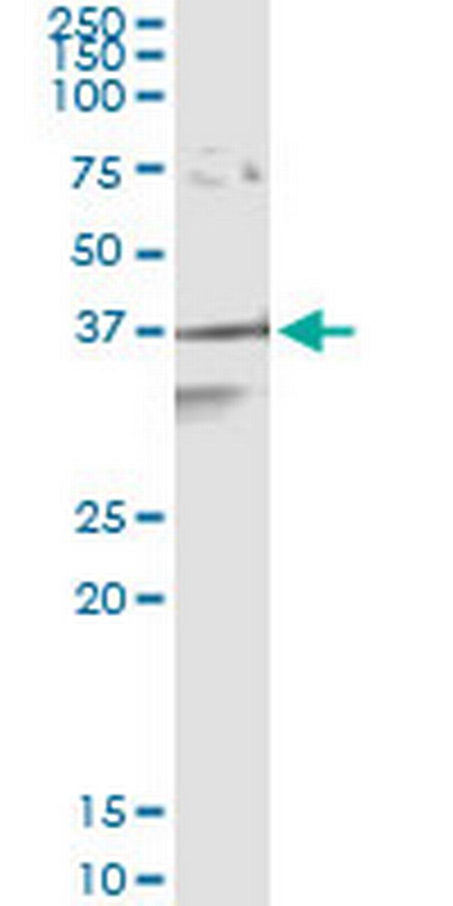 APEX1 Antibody in Immunoprecipitation (IP)