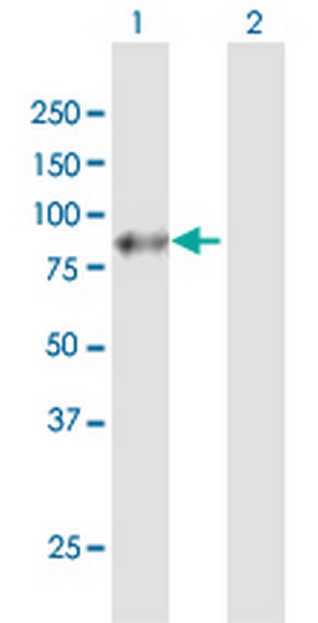 APLP1 Antibody in Western Blot (WB)