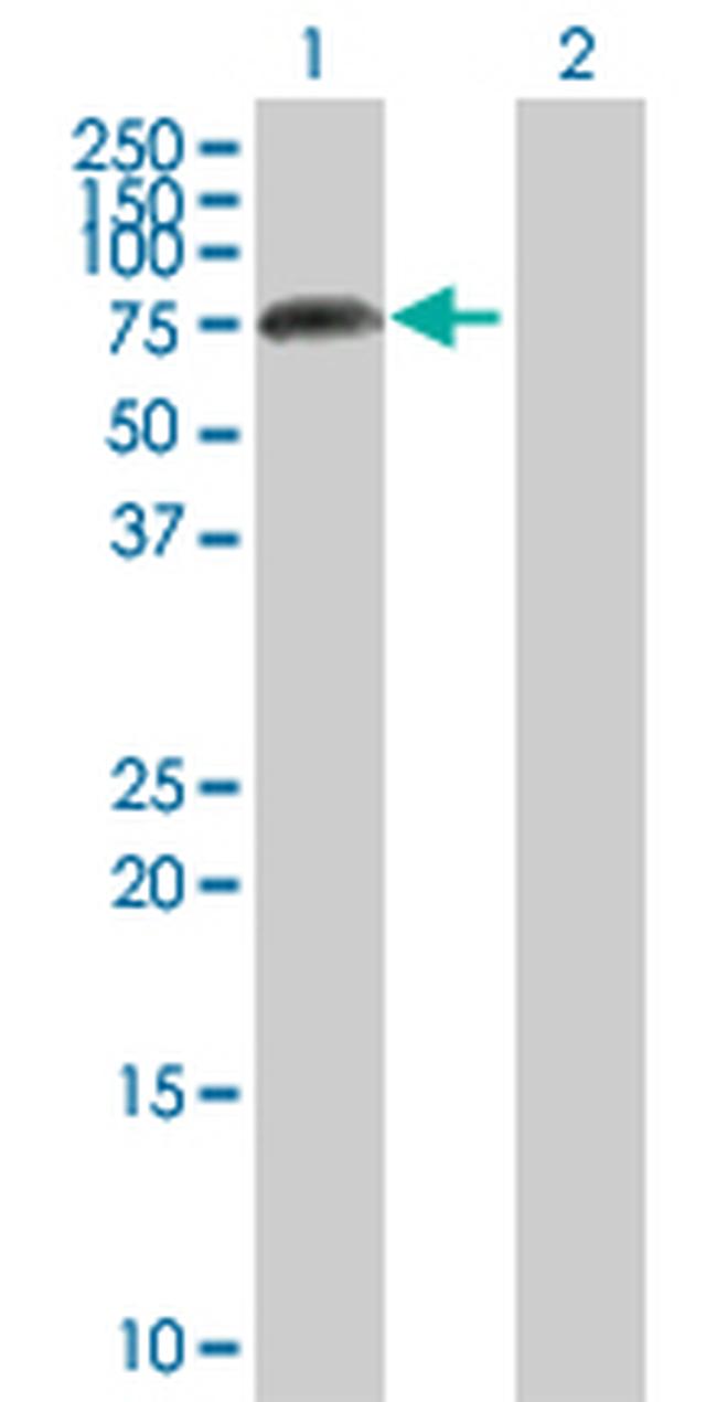 APLP2 Antibody in Western Blot (WB)