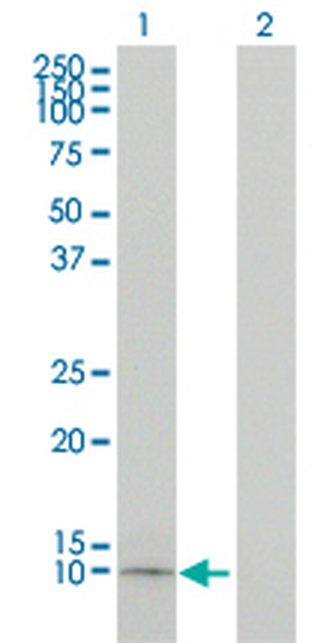 APOC1 Antibody in Western Blot (WB)