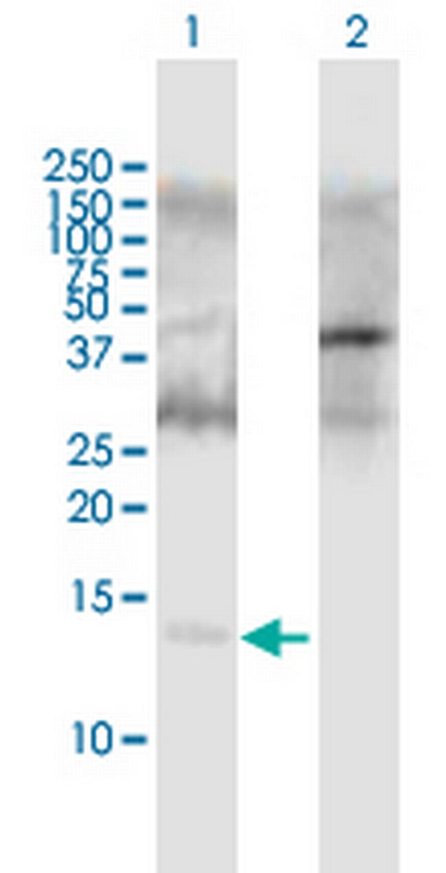 APOC2 Antibody in Western Blot (WB)