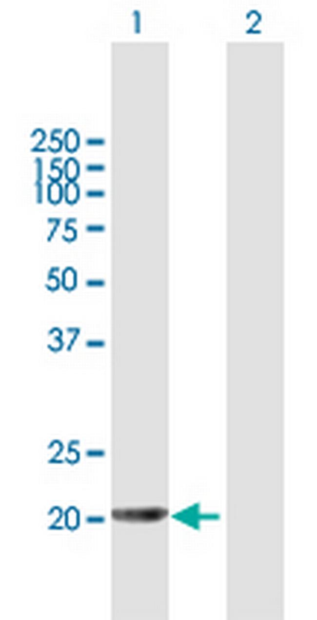 APRT Antibody in Western Blot (WB)