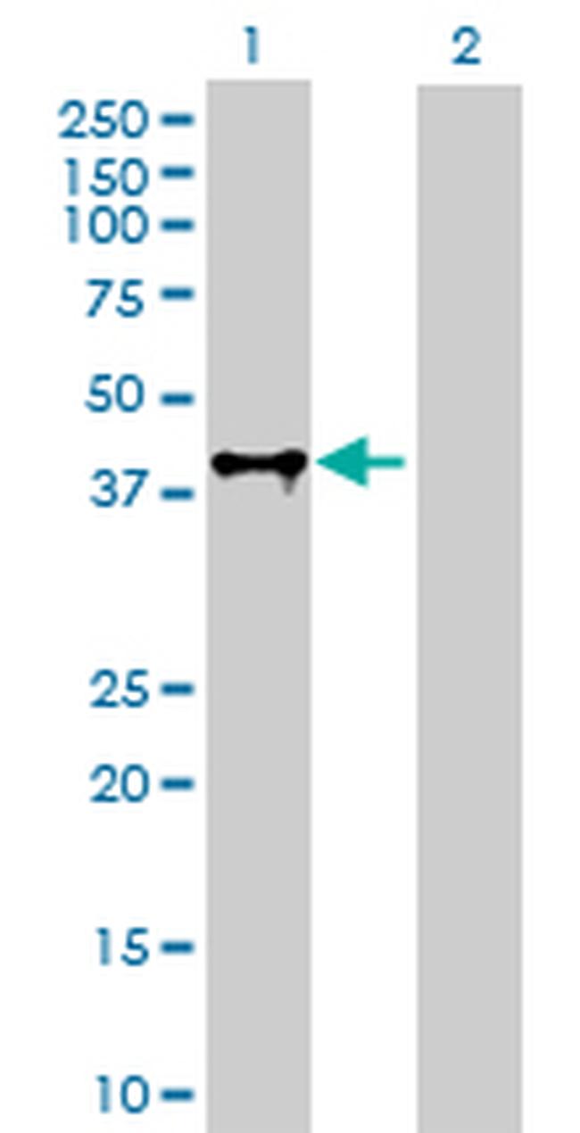 FAS Antibody in Western Blot (WB)