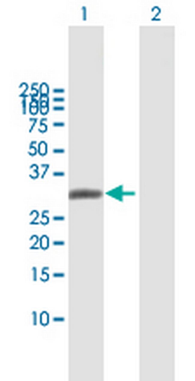 AQP7 Antibody in Western Blot (WB)