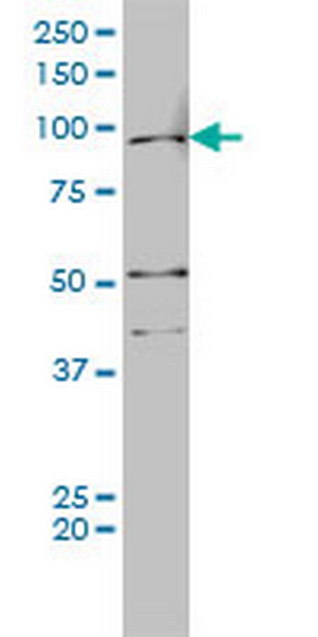 AR Antibody in Western Blot (WB)