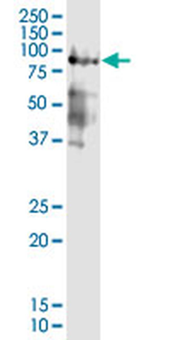 AR Antibody in Western Blot (WB)