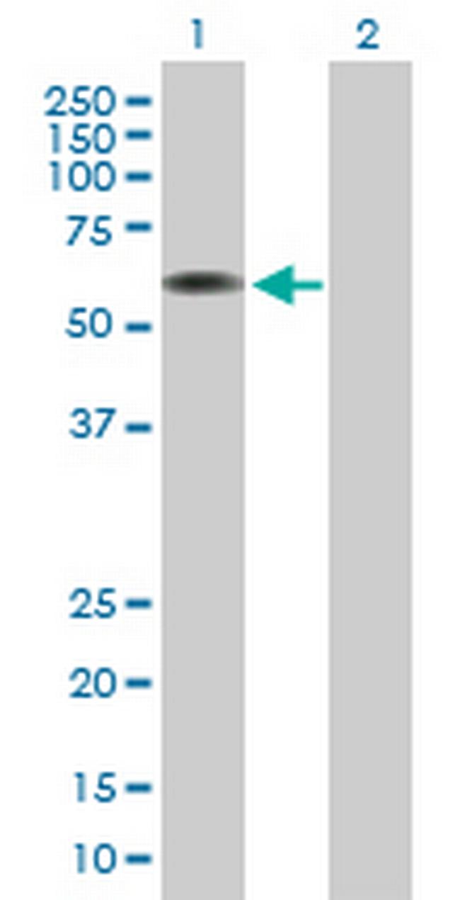 ARCN1 Antibody in Western Blot (WB)