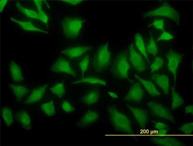 ARF5 Antibody in Immunocytochemistry (ICC/IF)