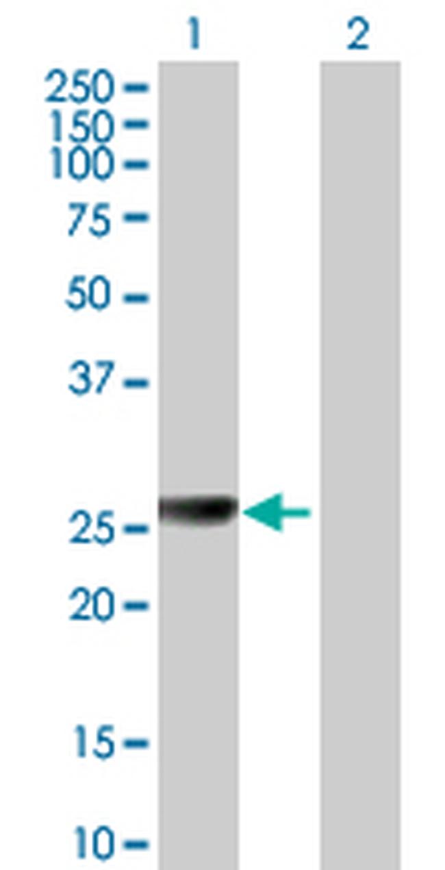 ARG1 Antibody in Western Blot (WB)