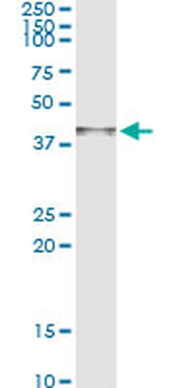 ARG2 Antibody in Immunoprecipitation (IP)