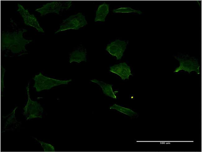 RHOC Antibody in Immunocytochemistry (ICC/IF)