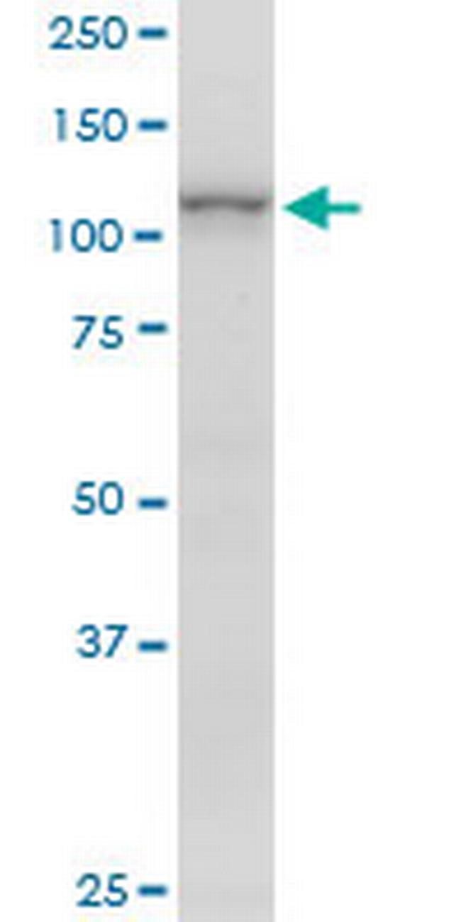 ARHGAP4 Antibody in Western Blot (WB)