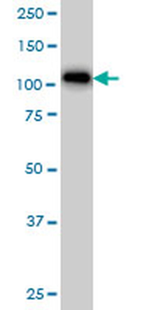 ARHGAP4 Antibody in Western Blot (WB)