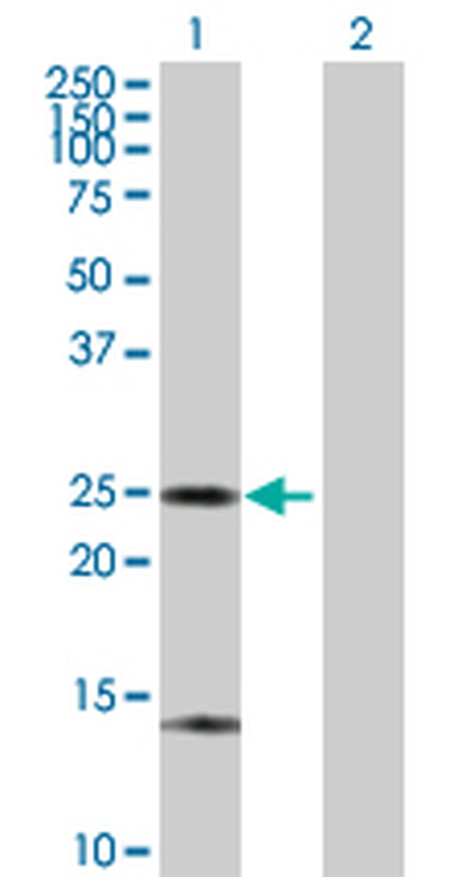 ARHGDIA Antibody in Western Blot (WB)