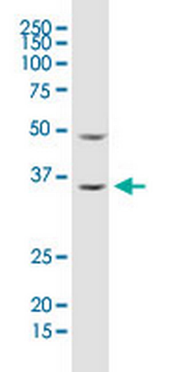 ARHGDIA Antibody in Western Blot (WB)