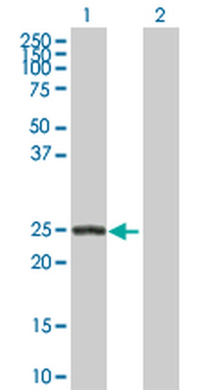 ARHGDIB Antibody in Western Blot (WB)