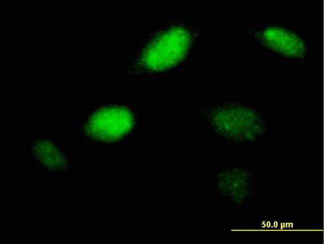 PHOX2A Antibody in Immunocytochemistry (ICC/IF)