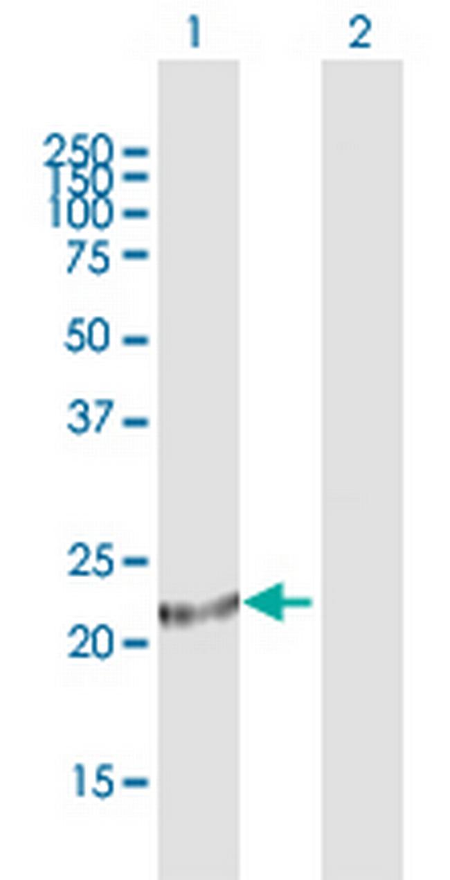 ARL3 Antibody in Western Blot (WB)