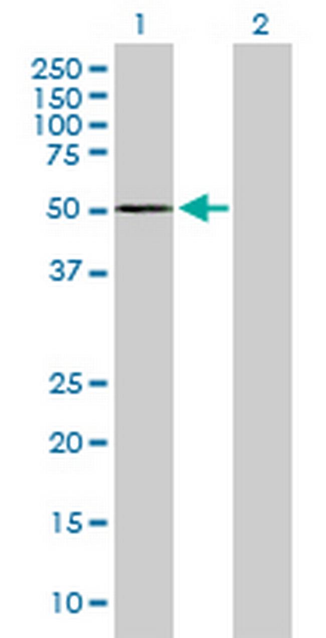 ARRB1 Antibody in Western Blot (WB)