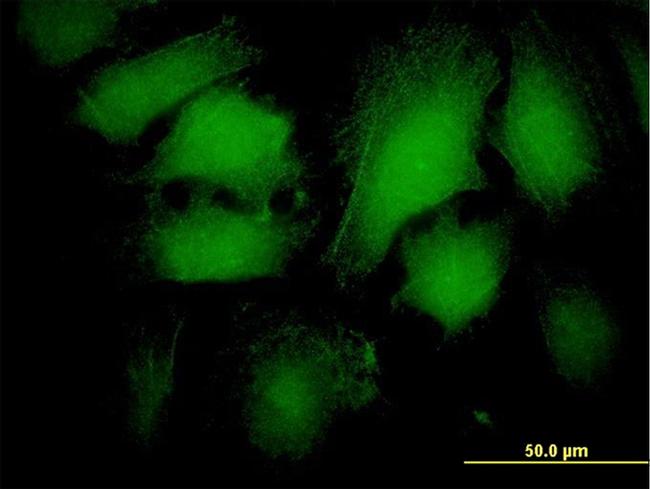 ARRB2 Antibody in Immunocytochemistry (ICC/IF)