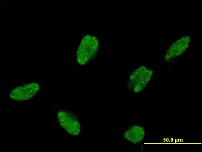 ASCL1 Antibody in Immunocytochemistry (ICC/IF)