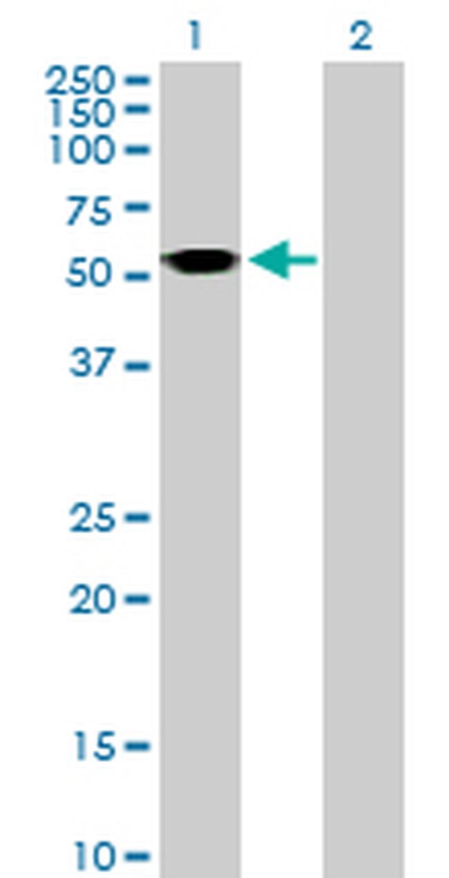 ASL Antibody in Western Blot (WB)