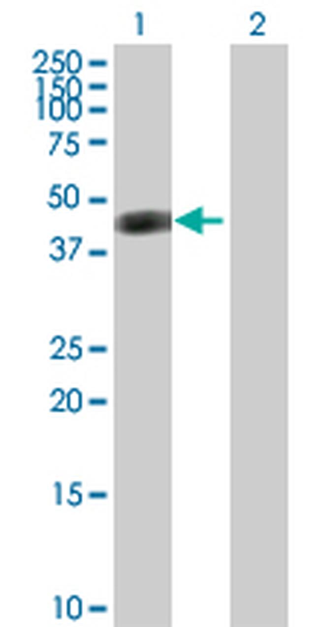 ASL Antibody in Western Blot (WB)