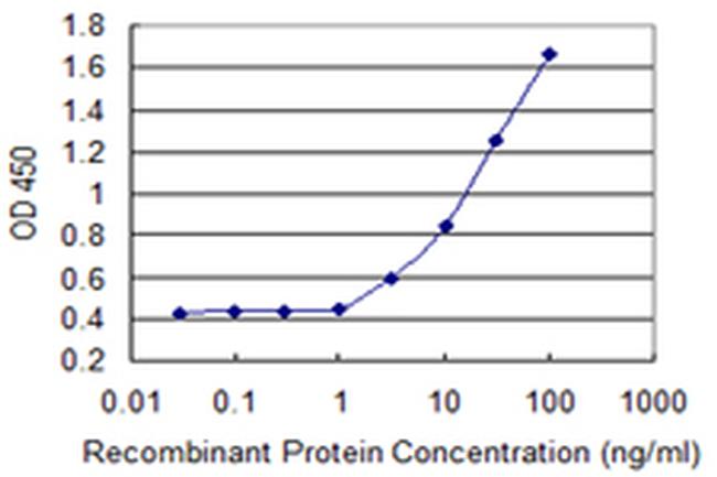 ASMT Antibody in ELISA (ELISA)