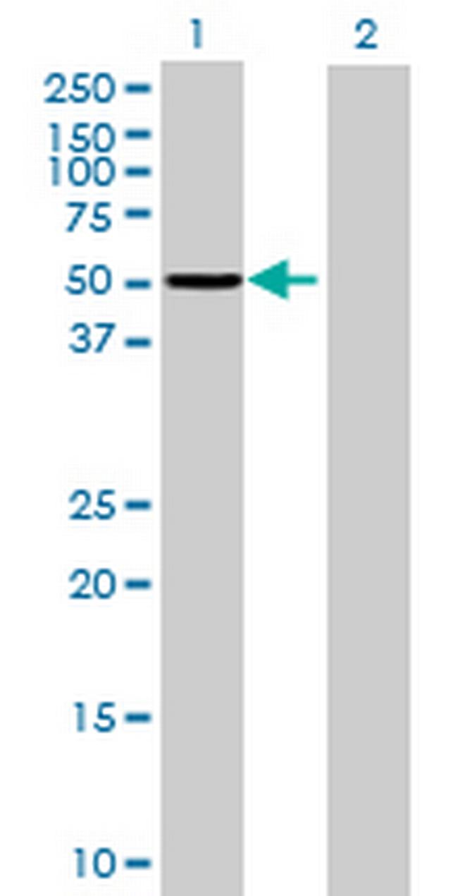 ASNS Antibody in Western Blot (WB)