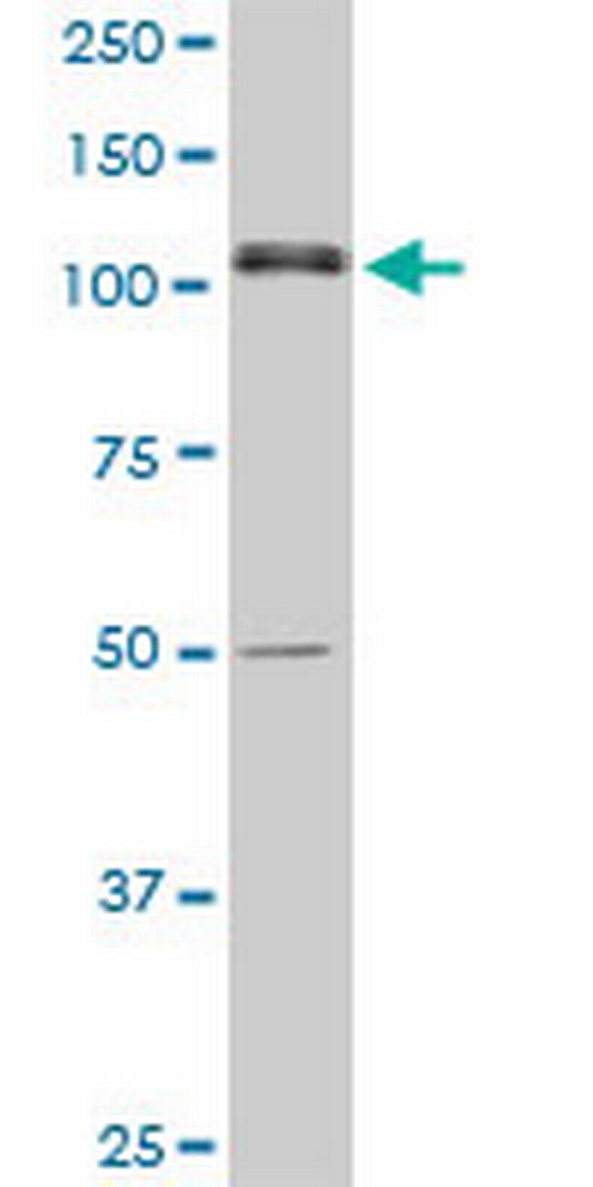 ASPH Antibody in Western Blot (WB)