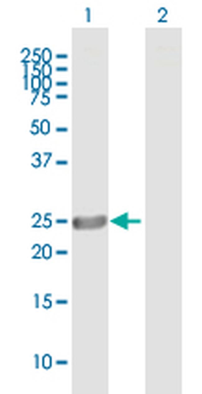 ASPH Antibody in Western Blot (WB)