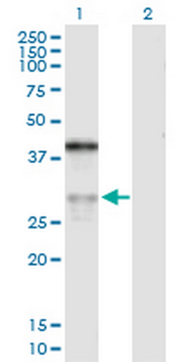 ASPH Antibody in Western Blot (WB)