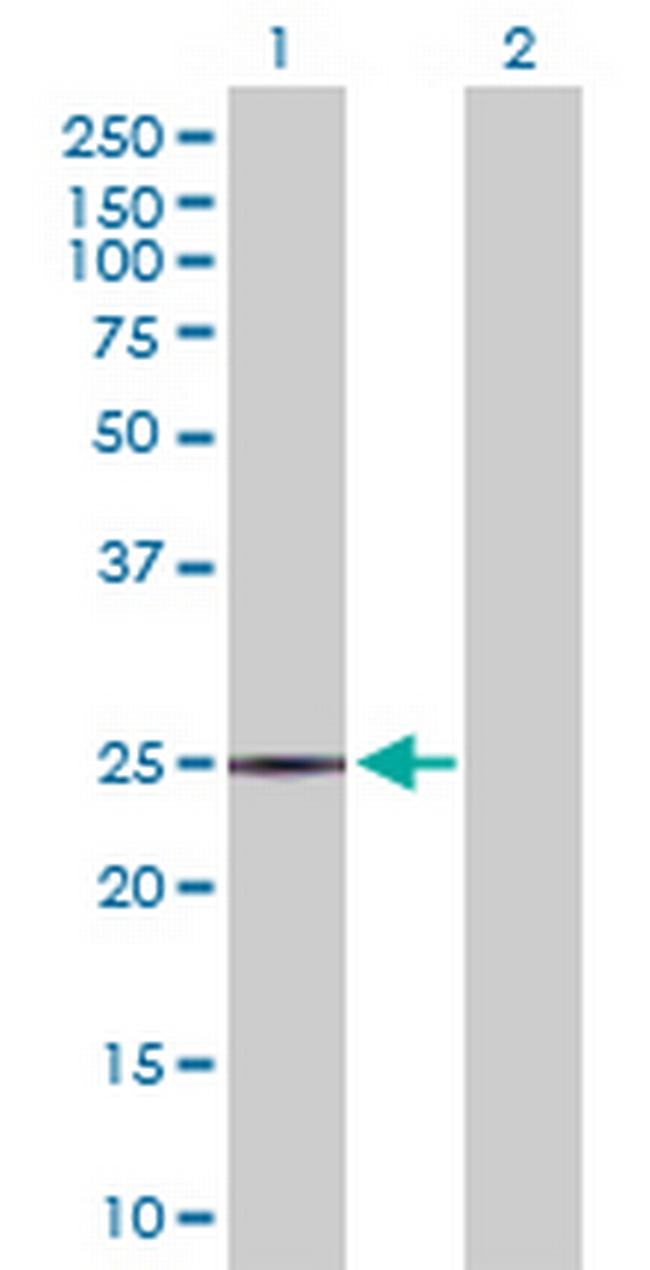 ASPH Antibody in Western Blot (WB)