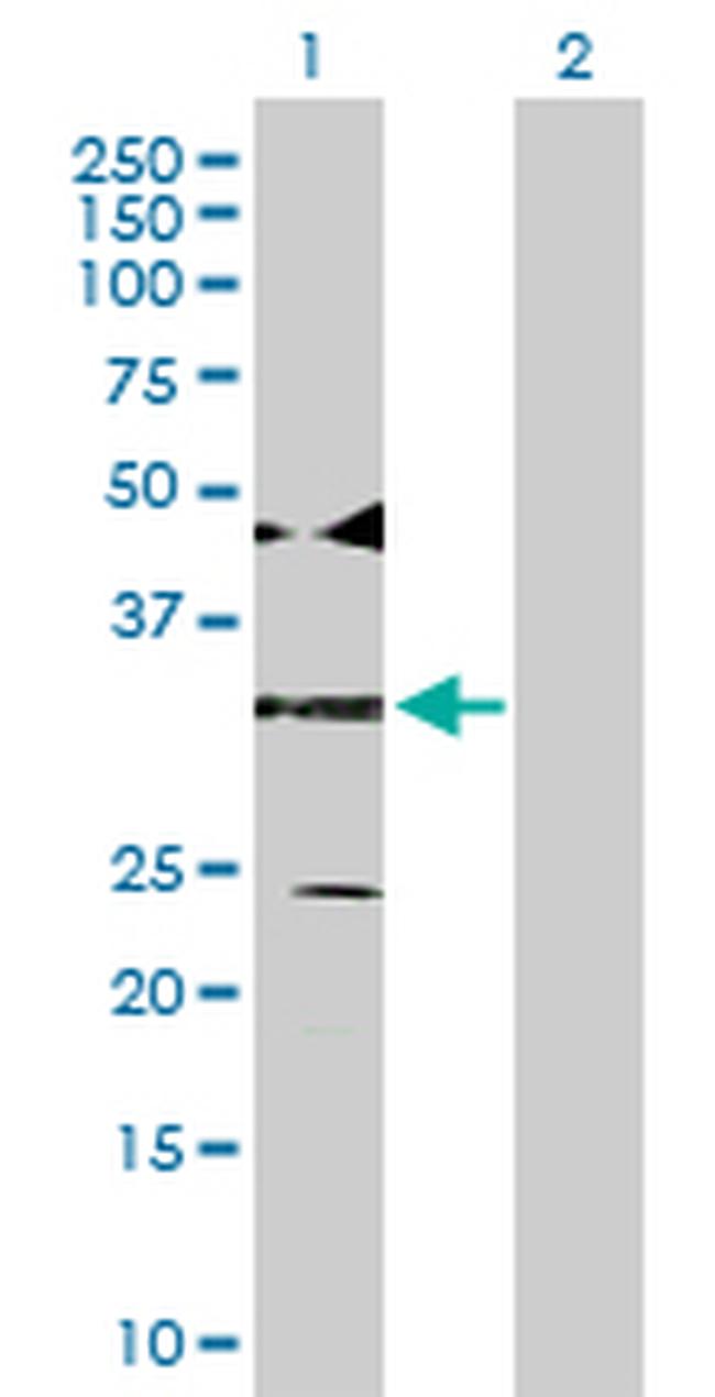 ATF4 Antibody in Western Blot (WB)