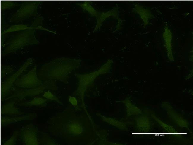 ATM Antibody in Immunocytochemistry (ICC/IF)