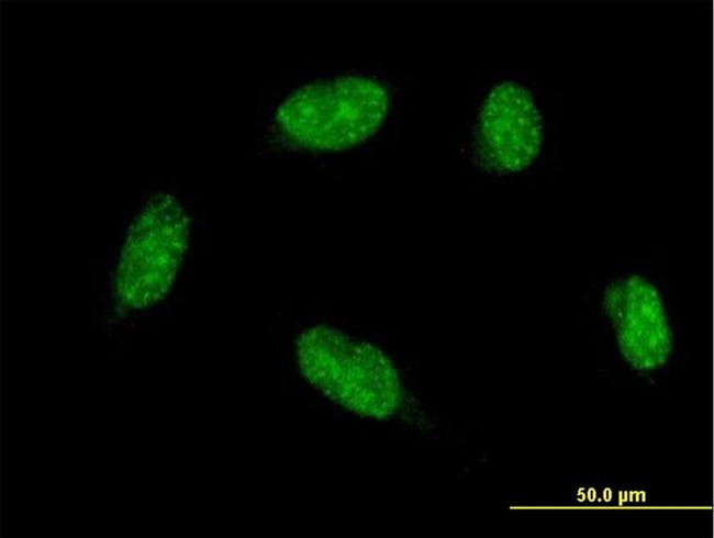 ATOH1 Antibody in Immunocytochemistry (ICC/IF)