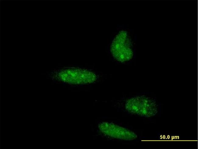 ATOH1 Antibody in Immunocytochemistry (ICC/IF)