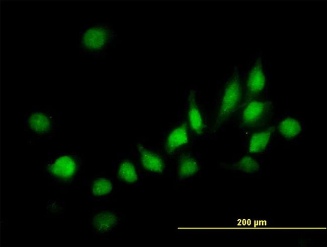 ATOX1 Antibody in Immunocytochemistry (ICC/IF)