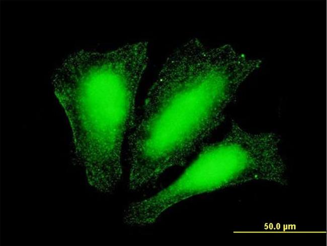 ATOX1 Antibody in Immunocytochemistry (ICC/IF)