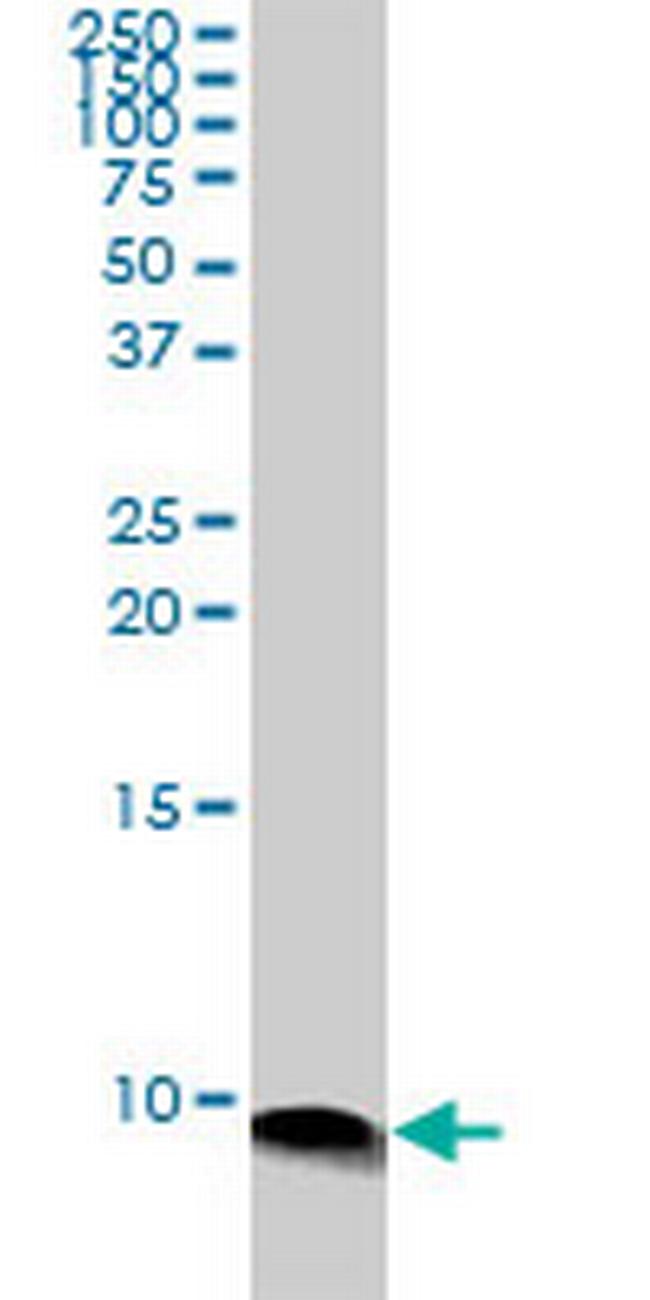 ATOX1 Antibody in Western Blot (WB)