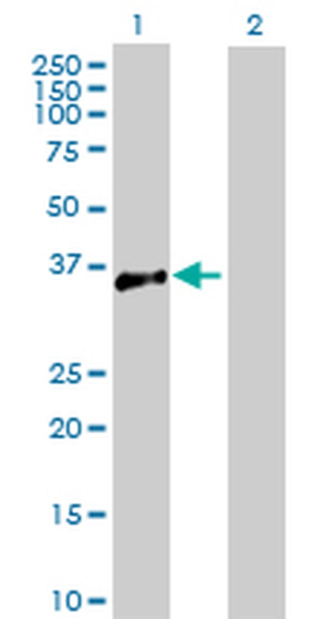 ATP1B3 Antibody in Western Blot (WB)