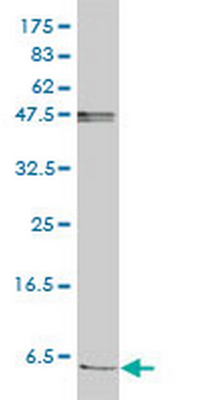 FXYD2 Antibody in Western Blot (WB)