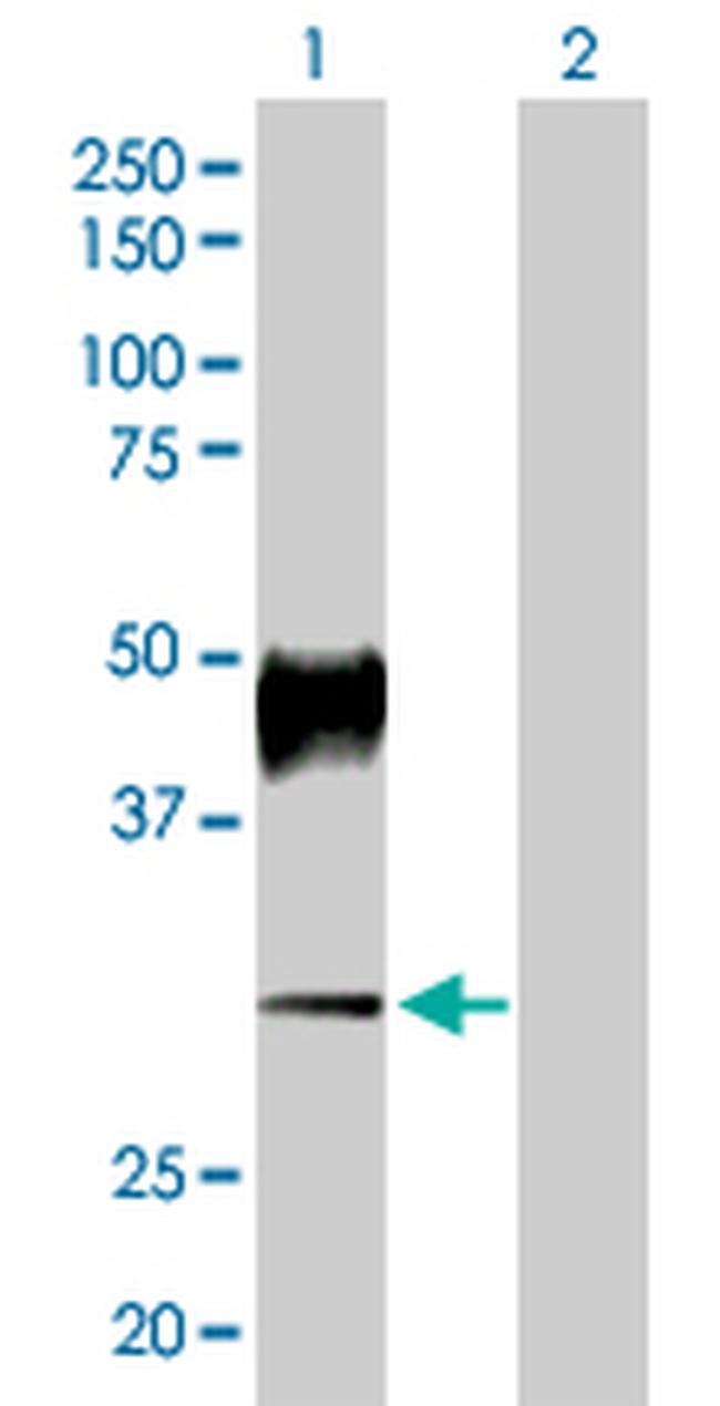 ATP4B Antibody in Western Blot (WB)